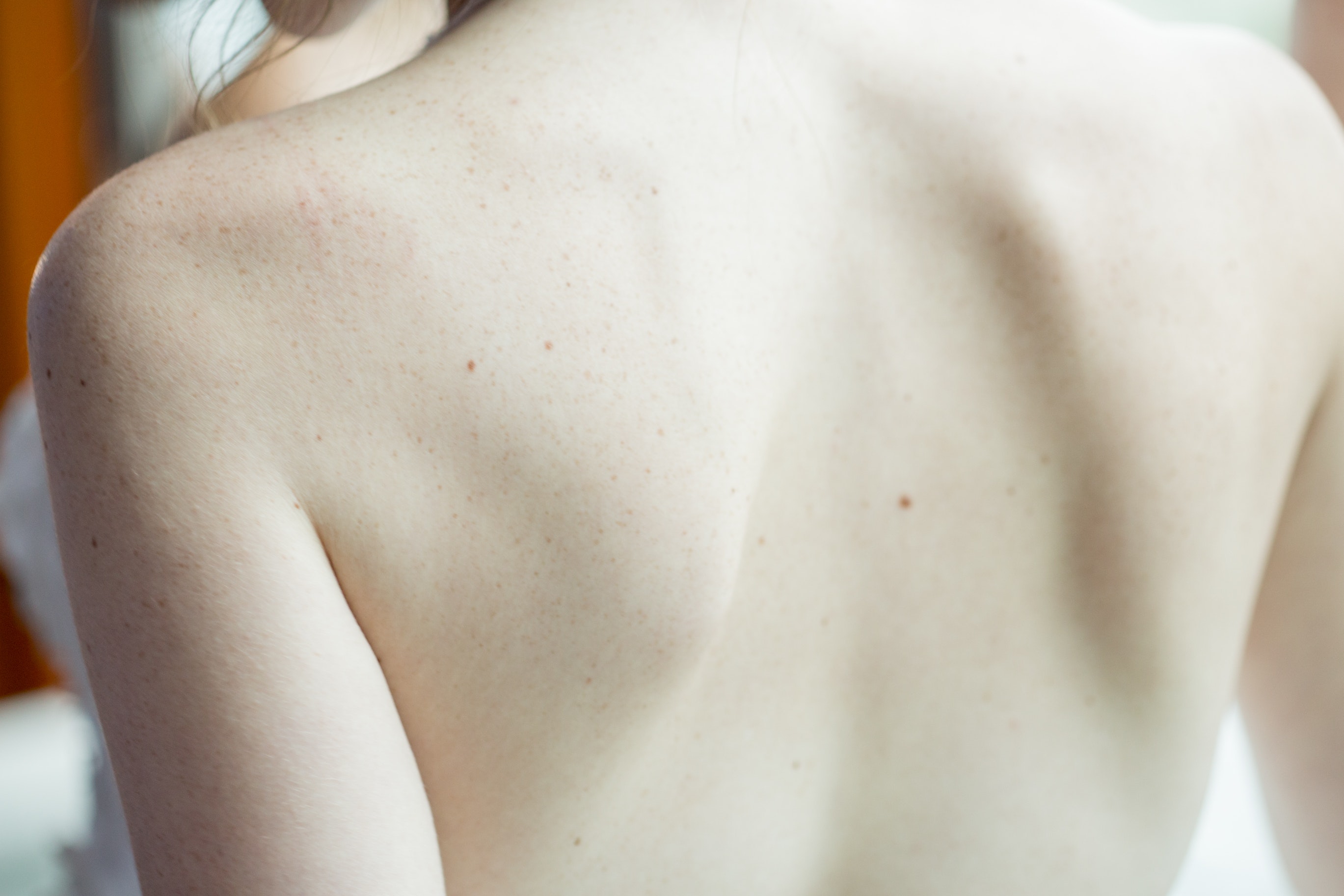 Έχεις ξηρό δέρμα; Να τι θέλουν να γνωρίζεις οι δερματολόγο για τη θεραπεία του