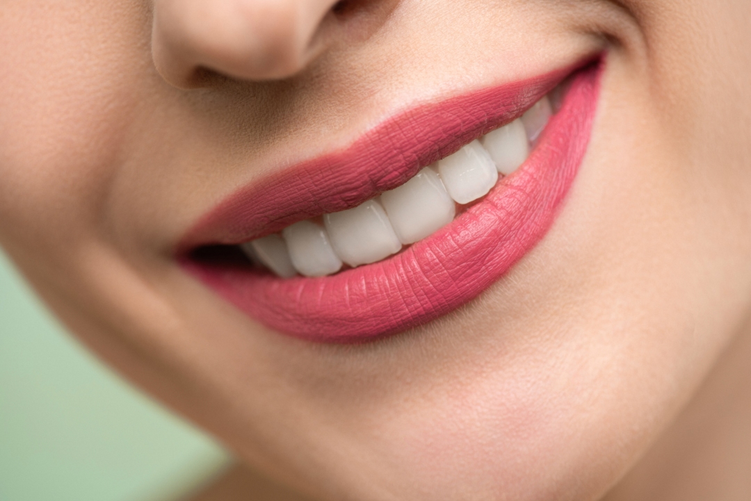 Λευκά δόντια με μια κίνηση χωρίς να επισκεφθείς οδοντίατρο; Kι όμως γινεται
