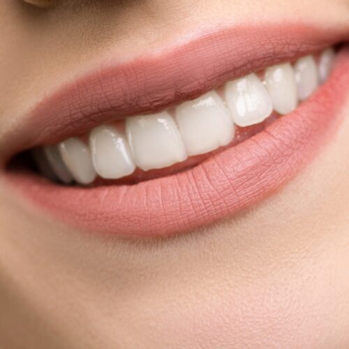 Πώς να μειώσεις τις λεπτές γραμμές γύρω από το στόμα, σύμφωνα με τους ειδικούς