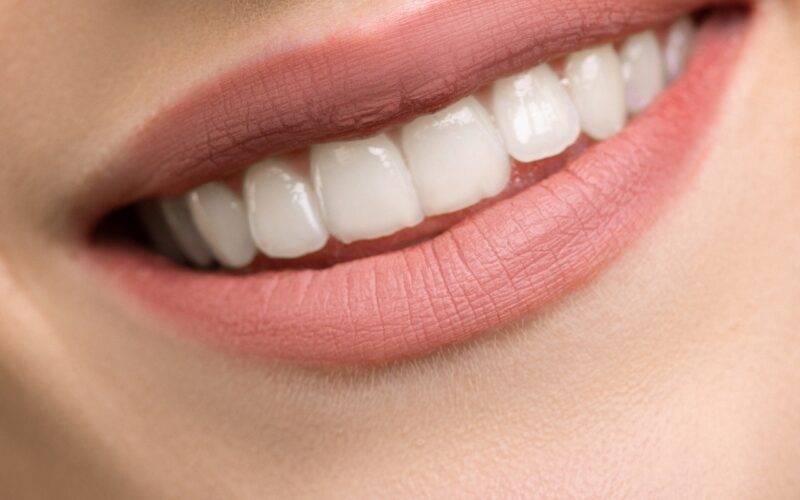 Πώς να μειώσεις τις λεπτές γραμμές γύρω από το στόμα, σύμφωνα με τους ειδικούς