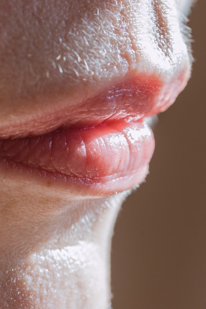 Τέλος στα σκασμένα χείλη! Πώς να προλάβεις να τα θεραπεύσεις πριν ξεφλουδίσουν