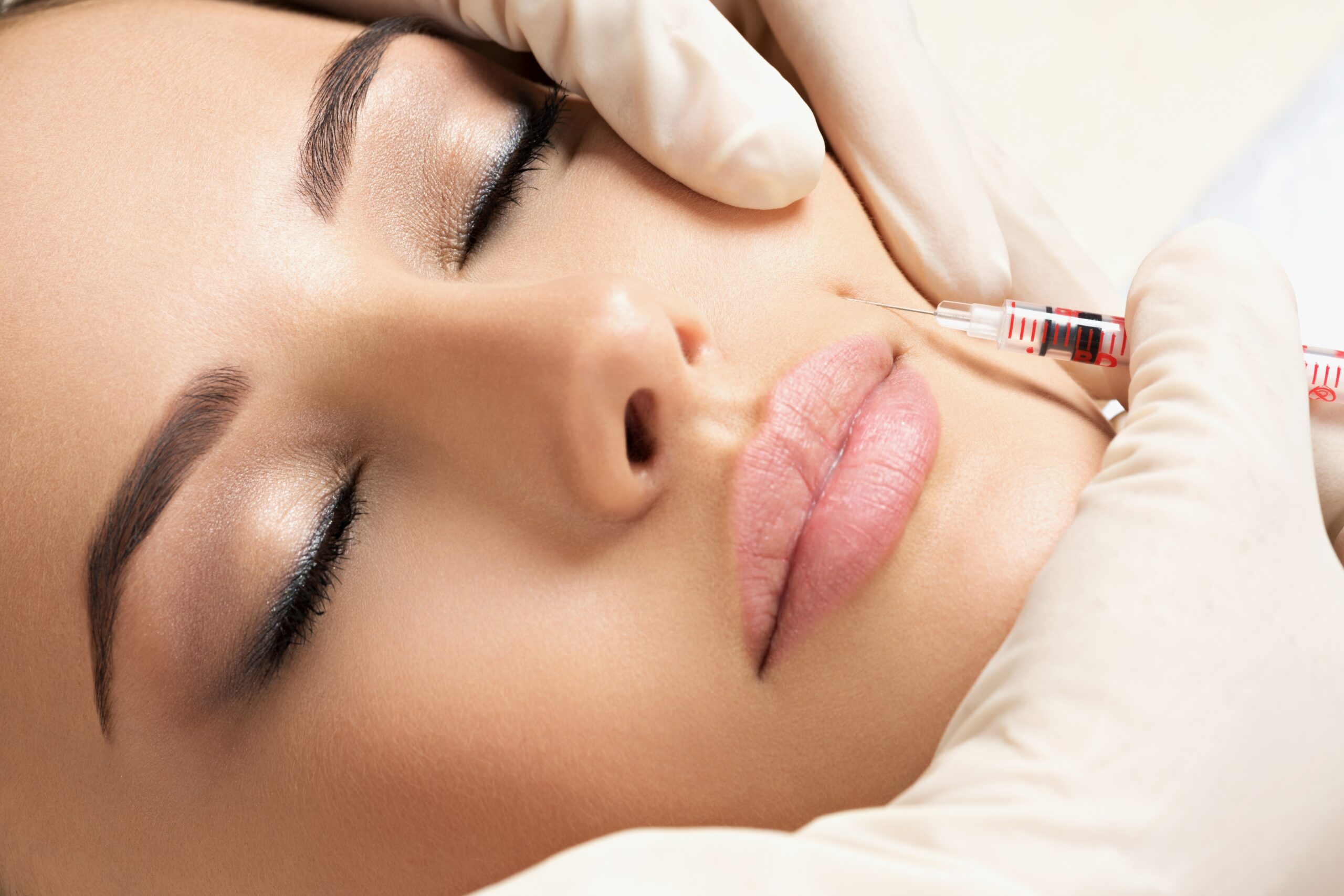 Botox: Όσα πρέπει να γνωρίζεις για την πιο διάσημη θεραπεία ομορφιάς