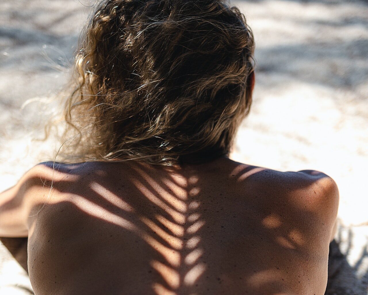 Το καλοκαίρι η αντιμετώπιση της ακμής στο σώμα είναι πιο εύκολη από όσο νομίζεις