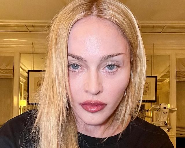 Η πρώτη ανάρτηση της Madonna μετά τη νοσηλεία της- Η εξομολόγηση για όσα την ανησυχούν
