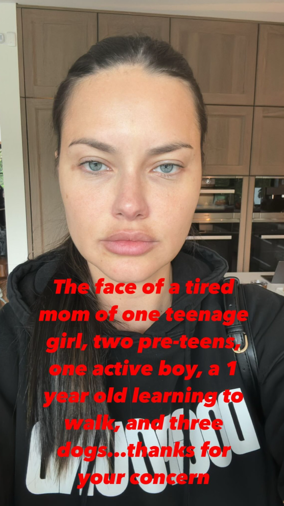 Η απάντηση της Adriana Lima στα σχόλια για επεμβάσεις: «Είμαι μια κουρασμένη μαμά»