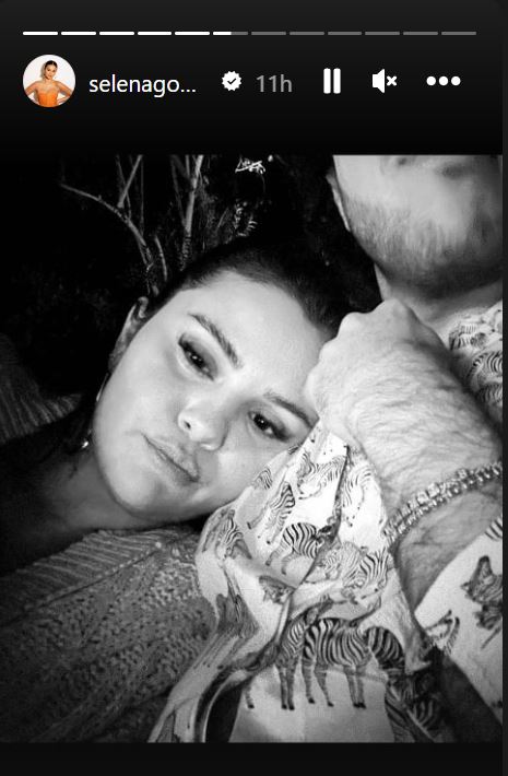 Η Selena Gomez αποκαλύπτει μέσω Instagram: «Έχω κάνει botox»