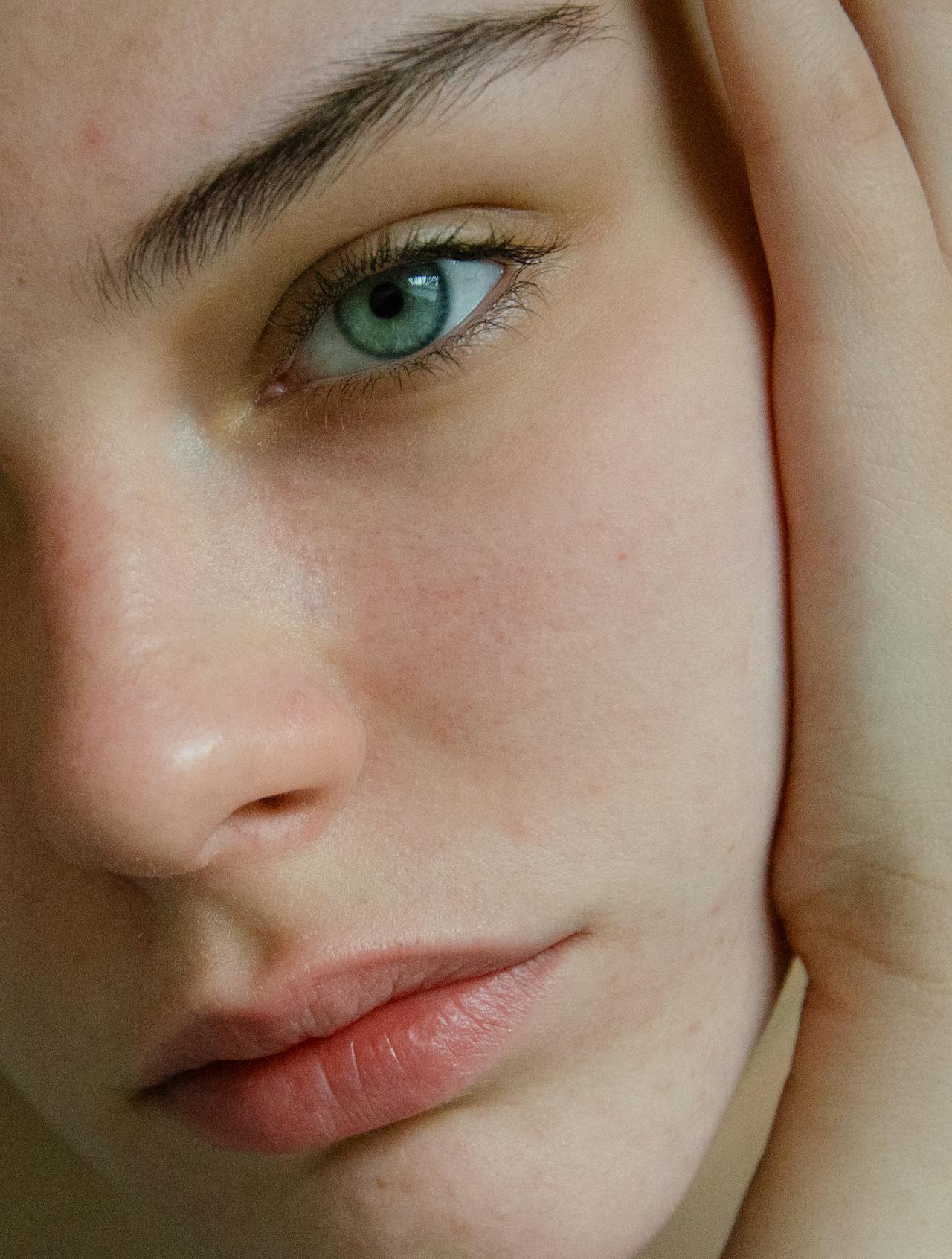 Στρες και δέρμα: Οι ορμόνες που εμπλέκονται όταν είσαι ασχωμένη και επηρεάζουν την επιδερμίδα σου