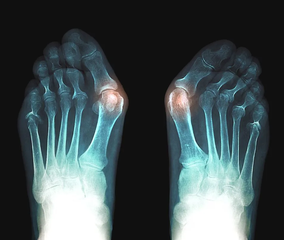 Αν έχεις κότσι και ταλαιπωρείσαι μια είναι η λύση