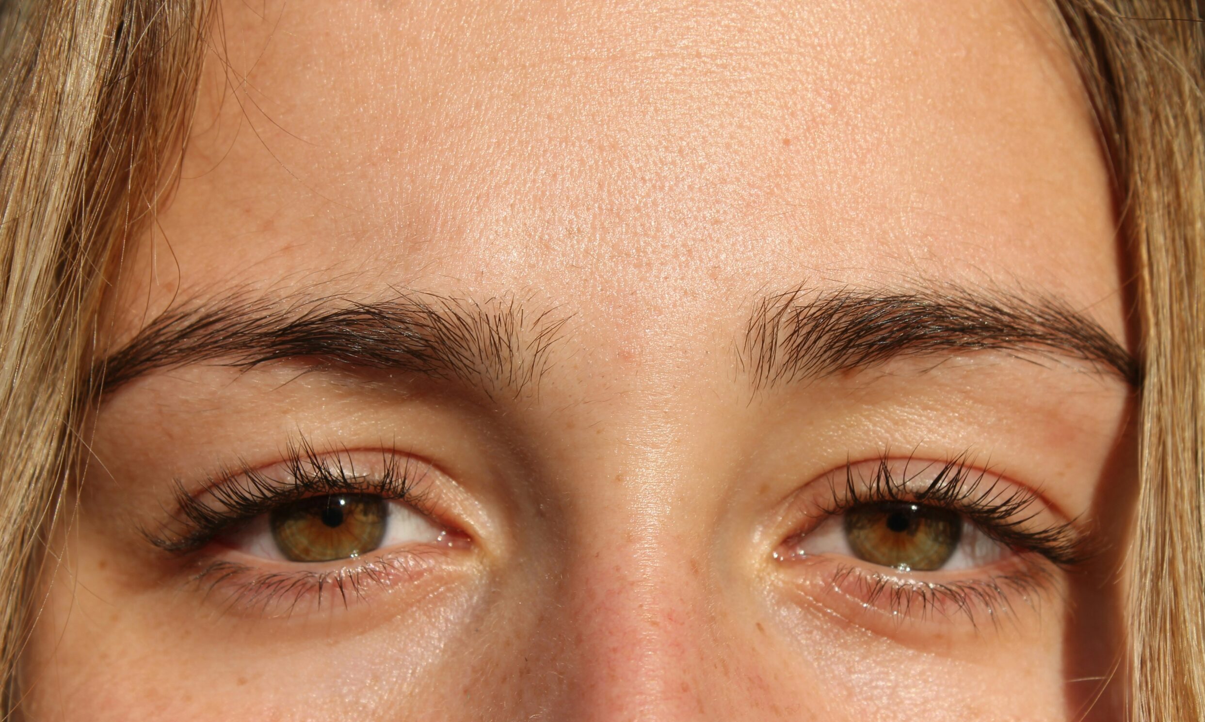 Πες «αντίο» στους μαύρους κύκλους – 5 τρόποι για φυσική αντιμετώπιση