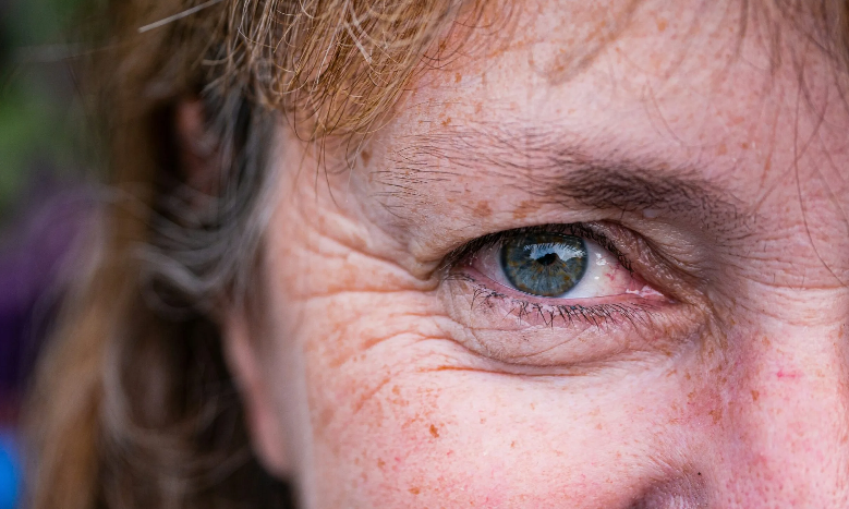 Δεν είναι οι ρυτίδες: Το πραγματικό σημάδι γήρανσης που σε κάνει να φαίνεσαι 20 χρόνια μεγαλύτερη – Η κρέμα που το καταπολεμά