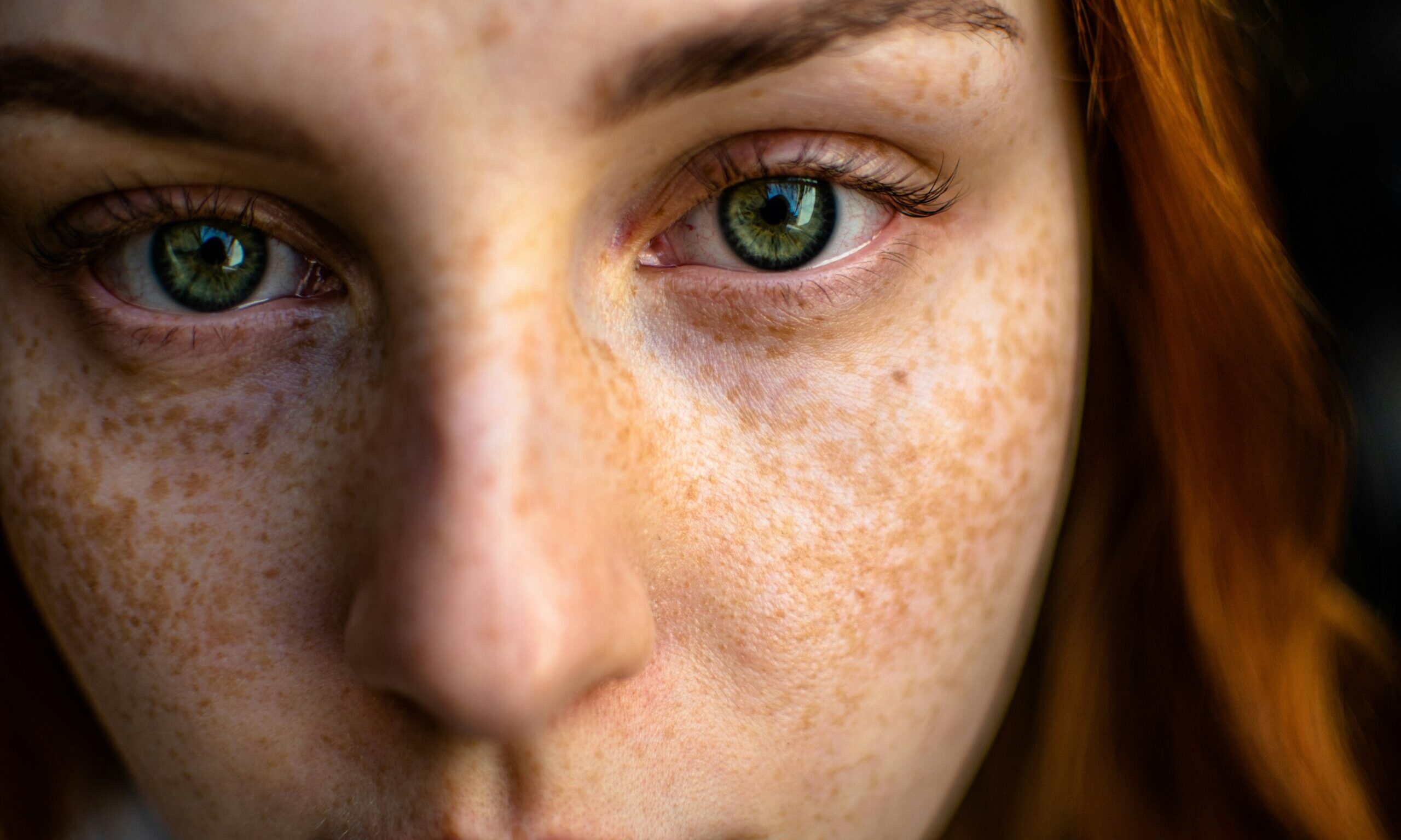 Πανάδες στο πρόσωπο: Πώς θα τις αντιμετωπίσεις με σύμμαχο τη skincare ρουτίνα σου