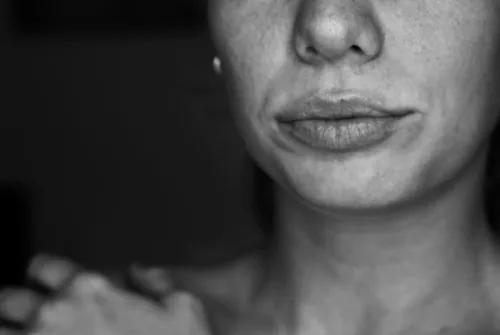 Η συνήθεια που δημιουργεί «ρυτίδες καπνιστή» χωρίς να καπνίζεις